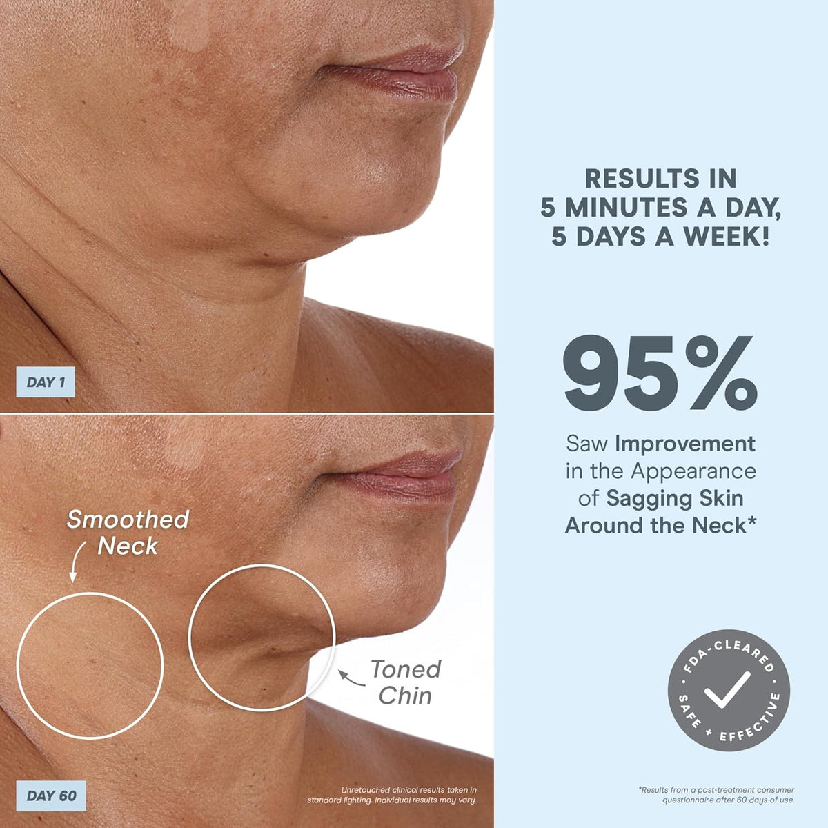 NuFACE MINI+ Microcurrent Facial Device Kit - FDA Cleared Face Sculpting & Skin Tightening Device
