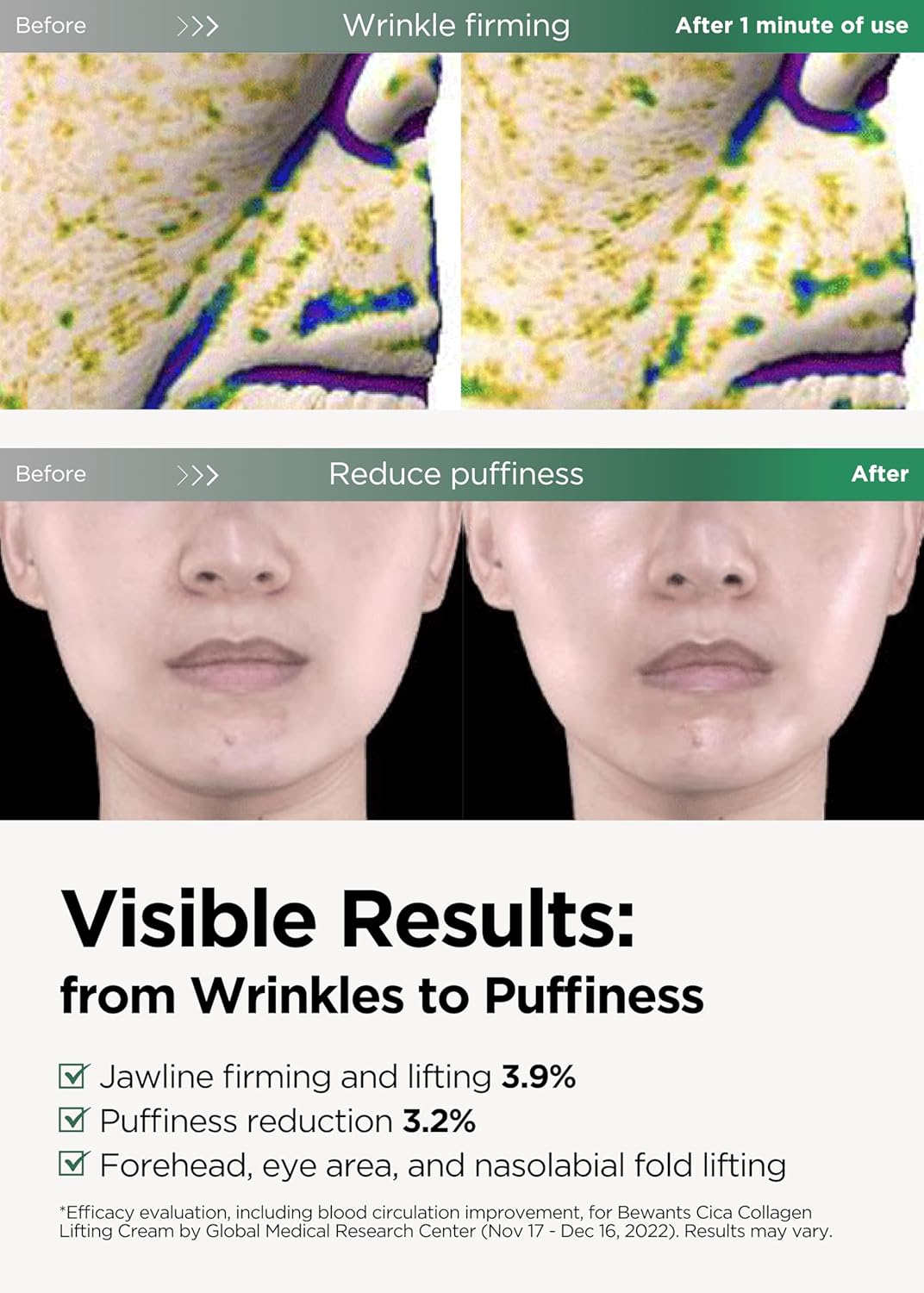 Bewants gua sha neck cream roller, korean neck cream with massage roller, rapid lift neck serum