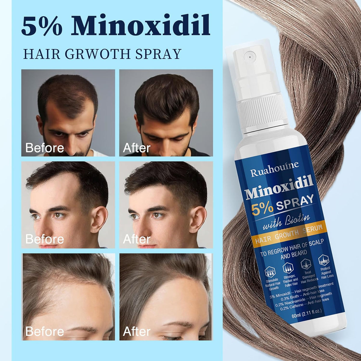 5% Minoxidil Hair Growth Spray Serum, Hair Regrowth Treatment for Men and Women, Strengthens and