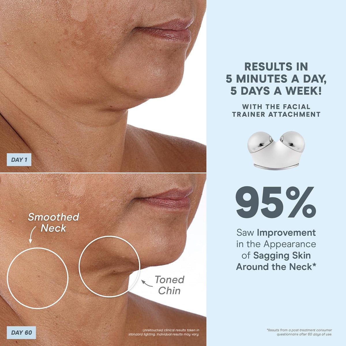 NuFACE TRINITY+ Microcurrent Facial Device Kit - FDA Cleared Face Sculpting & Neck Tightening