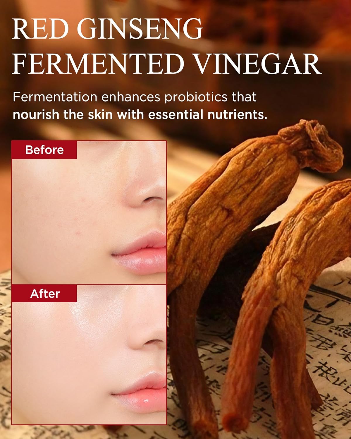 Bonyongo Red Ginseng Vinegar Skin Toner – Refreshing & Moisturizing Face Toner for Smooth, Youthful