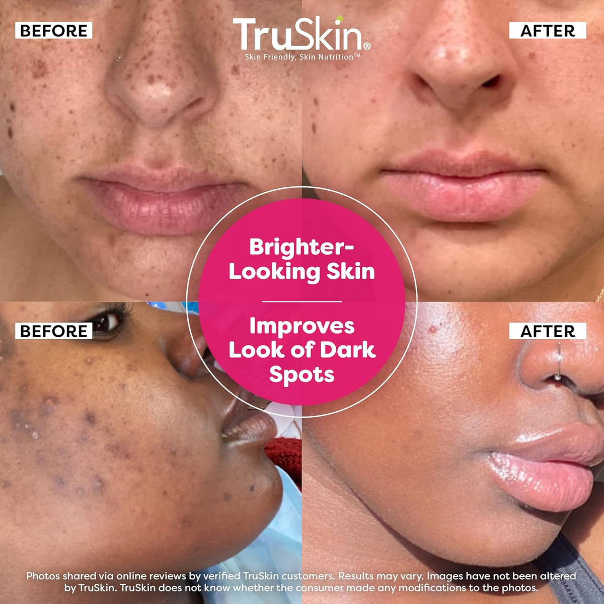 TruSkin Vitamin C Super Serum - Niacinamide, Retinol, Hyaluronic & Salicylic Acid - All-in-One Anti