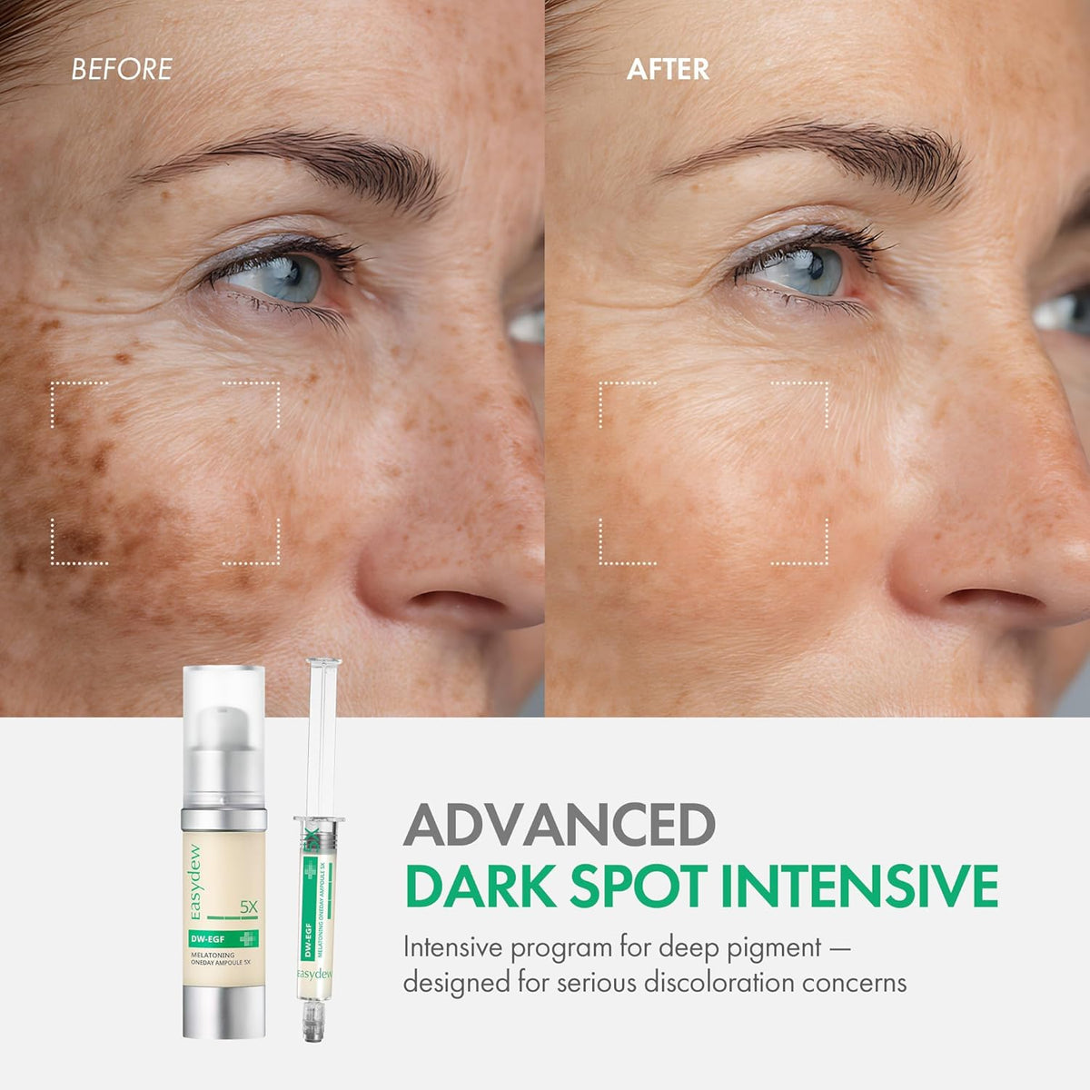 Easydew DW-EGF Melatoning Ampoule 5X - Hydrating Dark Spot Serum with Niacinamide & Glutathione for