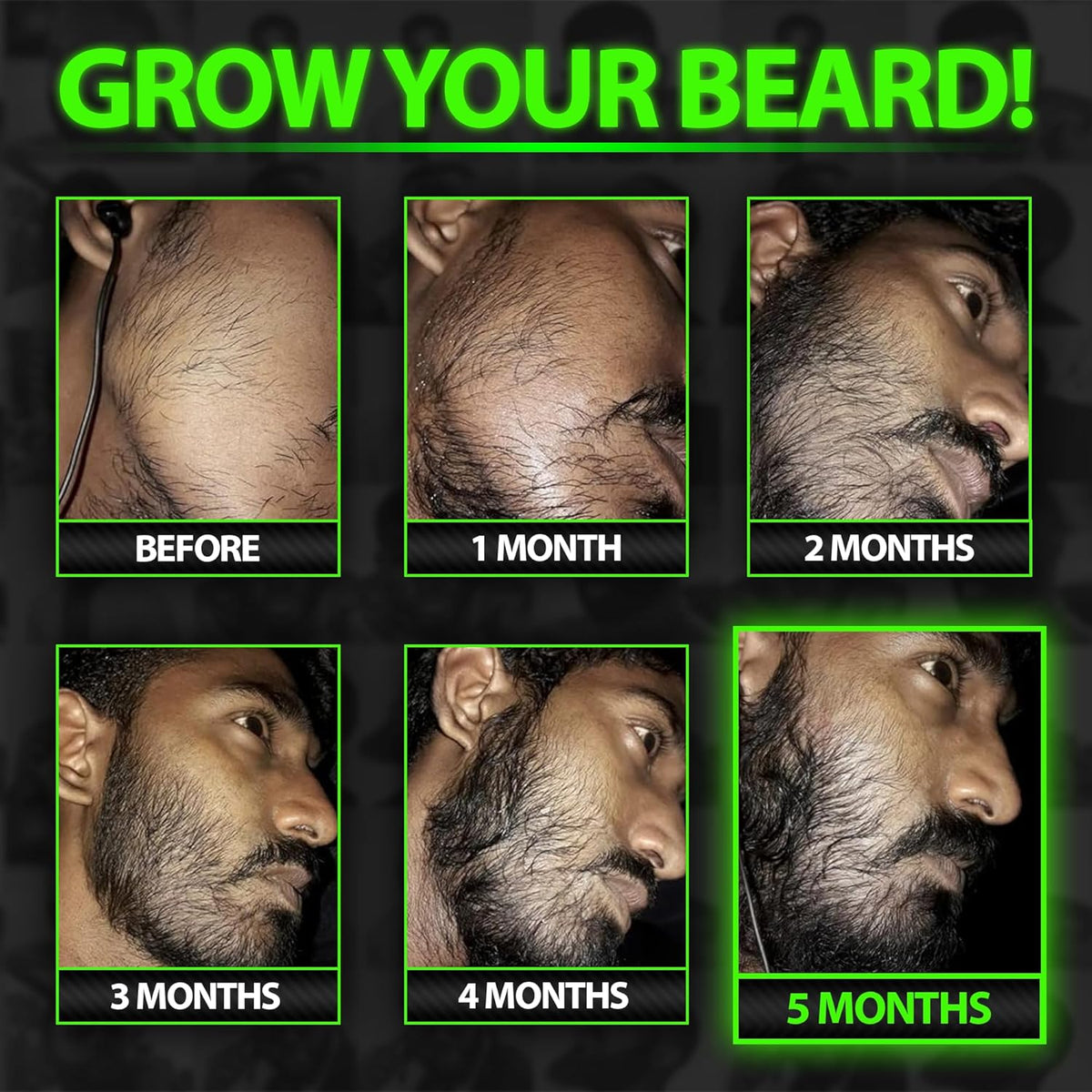 Beard Growth Kit w/GROW XXL Beard Serum for Maximum Facial Hair & Conditioner + GROW 11-in-1 Mens