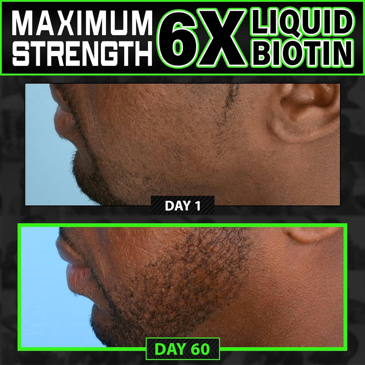 Beard Growth Kit w/ 2X Thickening Biotin Beard Balm/Beard Care & Beard Conditioner + 6X Liquid