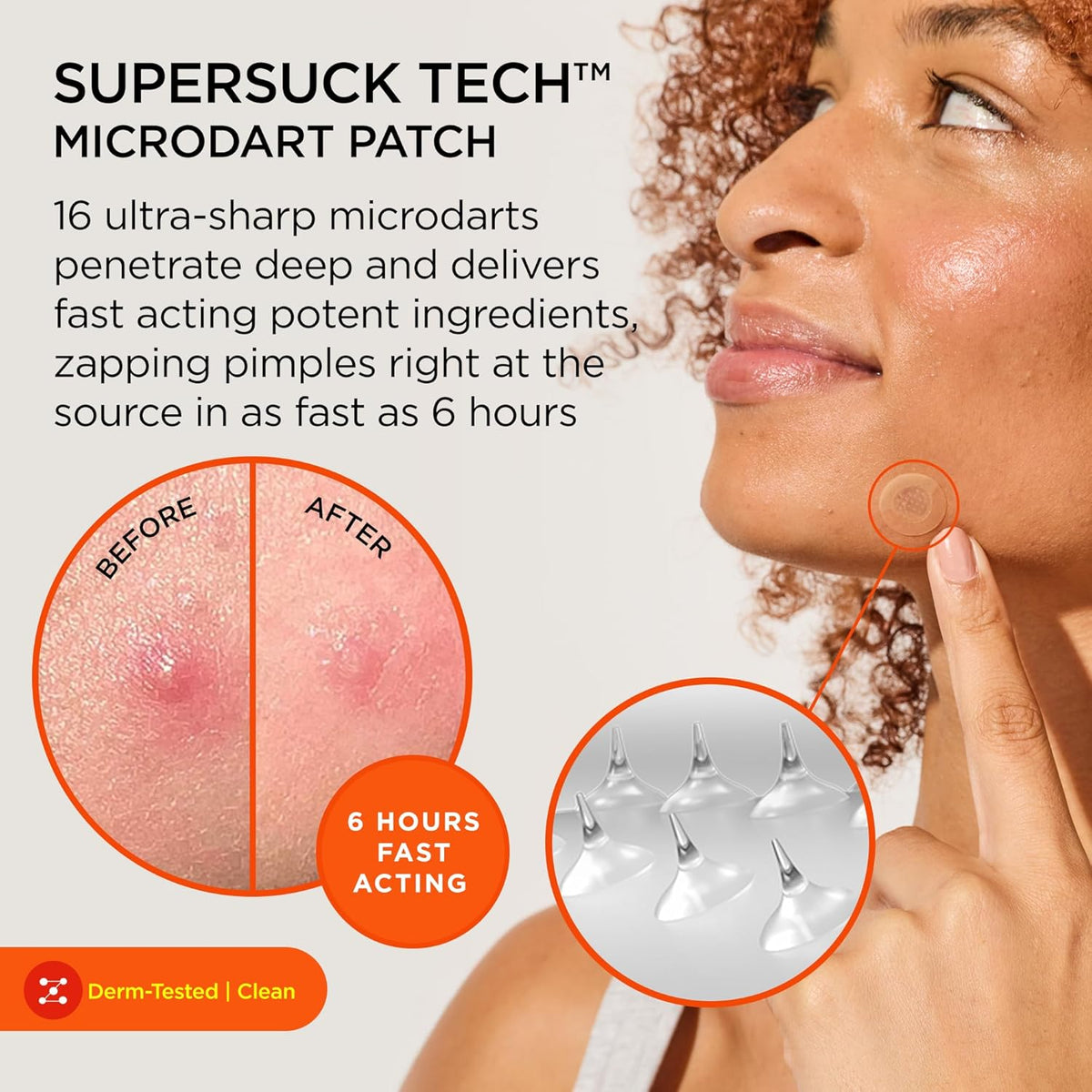ZitSticka Killa Pimple Patches for Face - World's Most Potent Pimple Patch with Fast-Acting