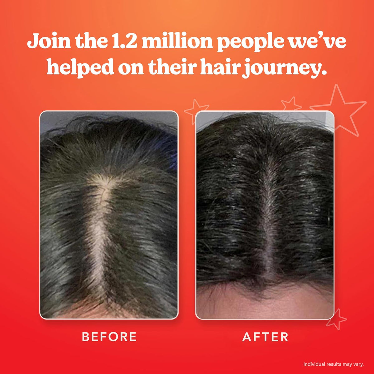 HAIRtamin Scalp Serum Natural Hair Growth Thickening | Made in USA | Helps Increase Hair Thickness