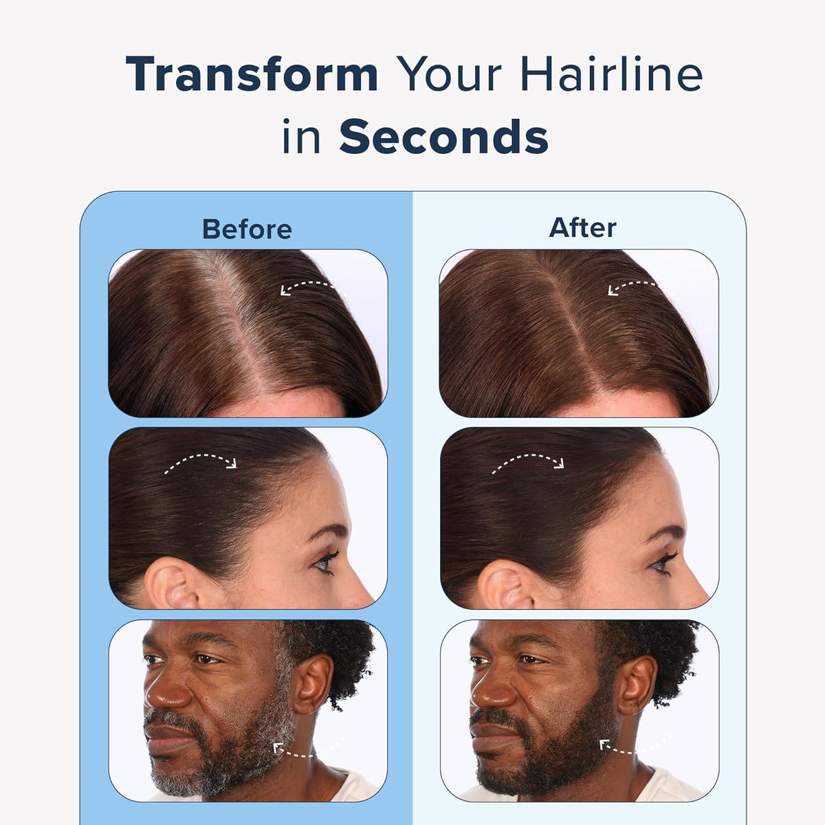 TRUHAIR Color & Conceal Waterproof Root Touch Up - Hair Cover Up for Gray Coverage and Hairline
