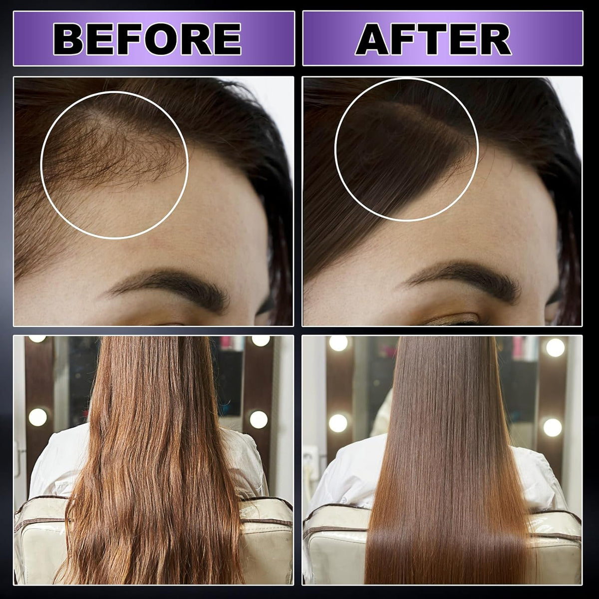 GIFBEA Organic Black Rice Water Hair Growth Serum Spray, 5 Fl Oz, Rosemary Scent, For All Hair