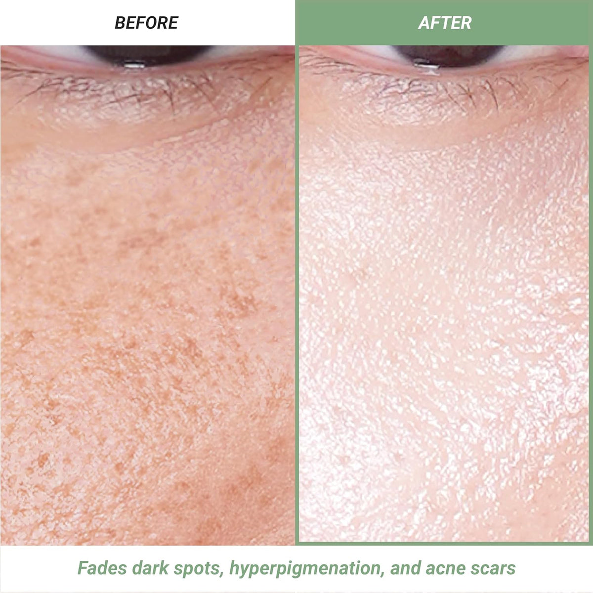 Meebak Korean Vitamin C Serum | Brightening Dark Spot Remover | Soothing Anti Aging & Skin