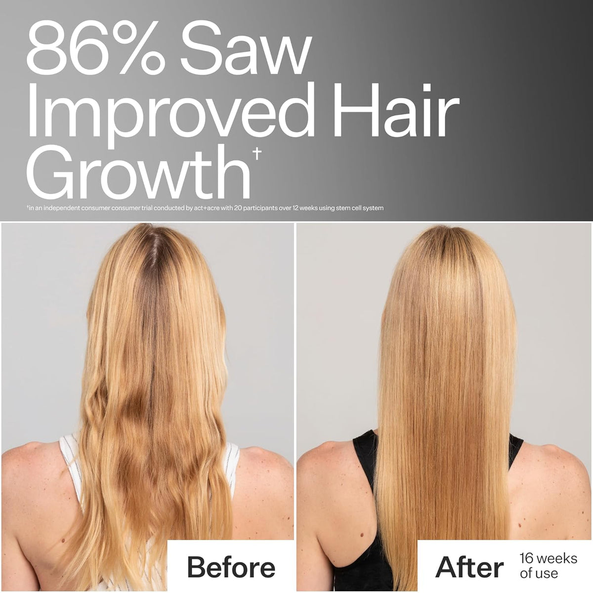 ACT+ ACRE Stem Cell Shampoo | Boosts Density, Hydrates Scalp, Removes Build-Up | Thicker, Fuller
