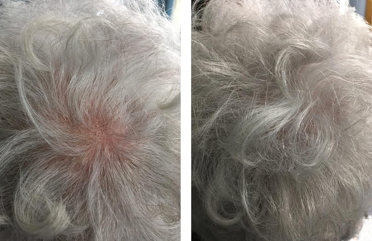 Caboki Hair Loss Concealer. All-Natural Hair Building Fiber. Make Thin Hair Look 10X Fuller