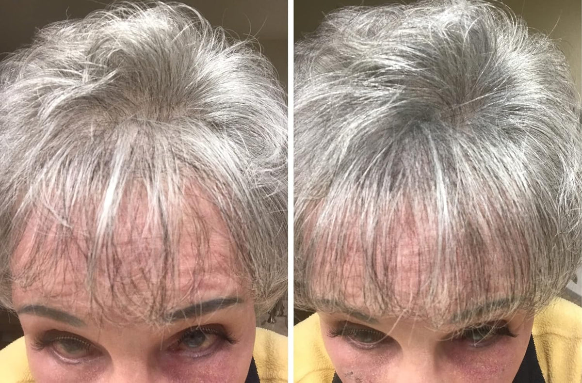 Caboki Hair Loss Concealer. All-Natural Hair Building Fiber. Make Thin Hair Look 10X Fuller