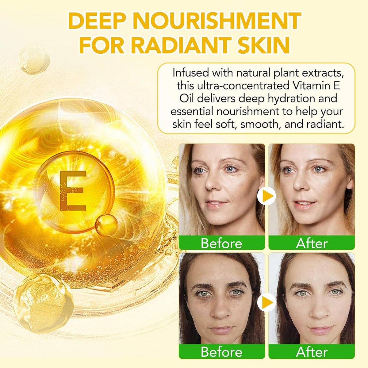 Vitamin E Oil for Skin 75,000 IU, 2Fl Oz Pure Vitamin e Oil for Scars, Hair, Face and Scalp