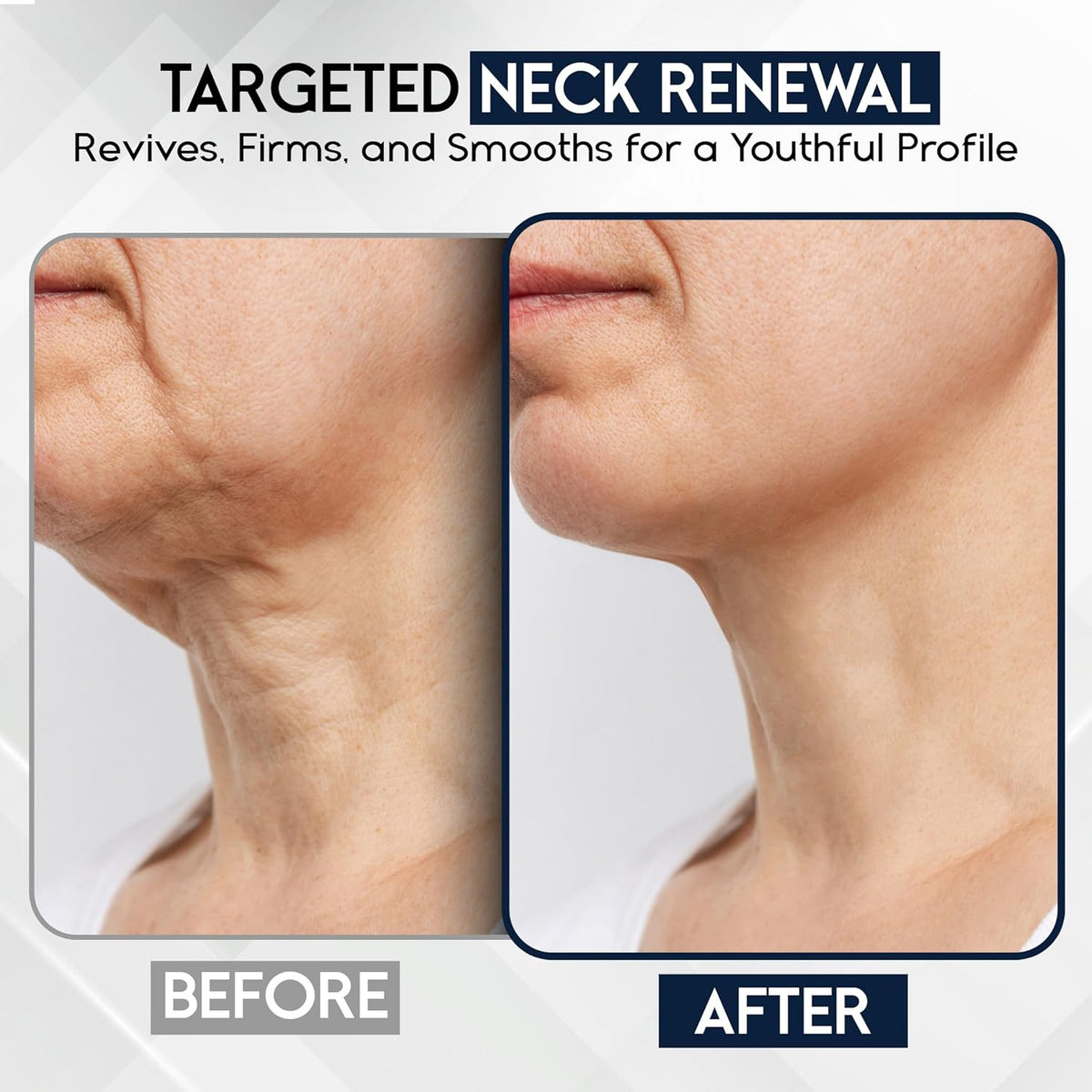 Neck Creams for Tightening and Firming Sagging Skin - Skin Tightening Cream for Face - Decollete &