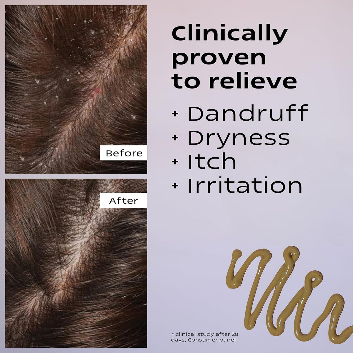 KAMEDIS Scalp Moisturizer Lotion For Dry, Itchy, Dandruff, Flaky, Seborrheic Dermatitis, Psoriasis