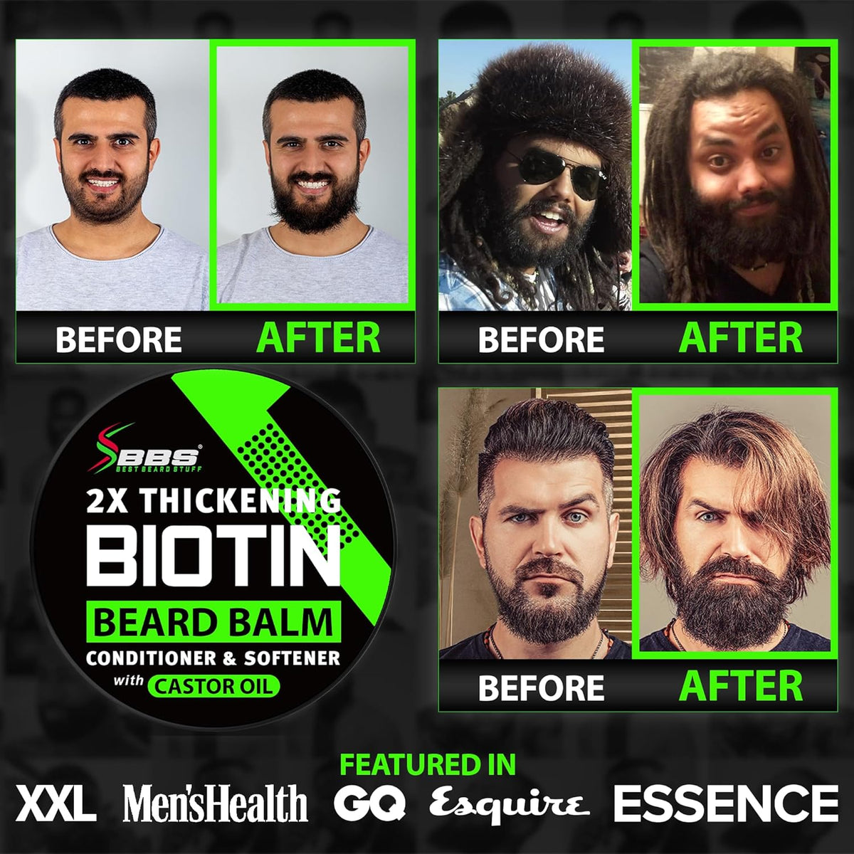 Beard Growth Kit w/ 2X Thickening Biotin Beard Balm/Beard Care & Beard Conditioner + 6X Liquid