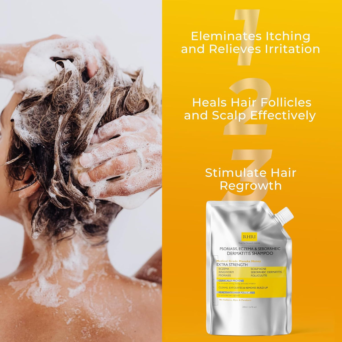 Antifungal Psoriasis Shampoo, Eczema, Seborrheic Dermatitis Shampoo | Soothes Itching, Flaking &