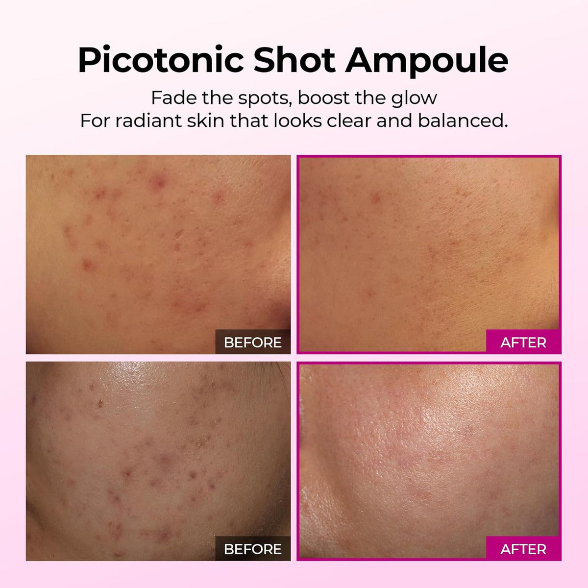 Cemenrete Picotonic Shot Calcium Ampoule for Even Skin Tone & Skin Clarity, 1.01 fl.oz.