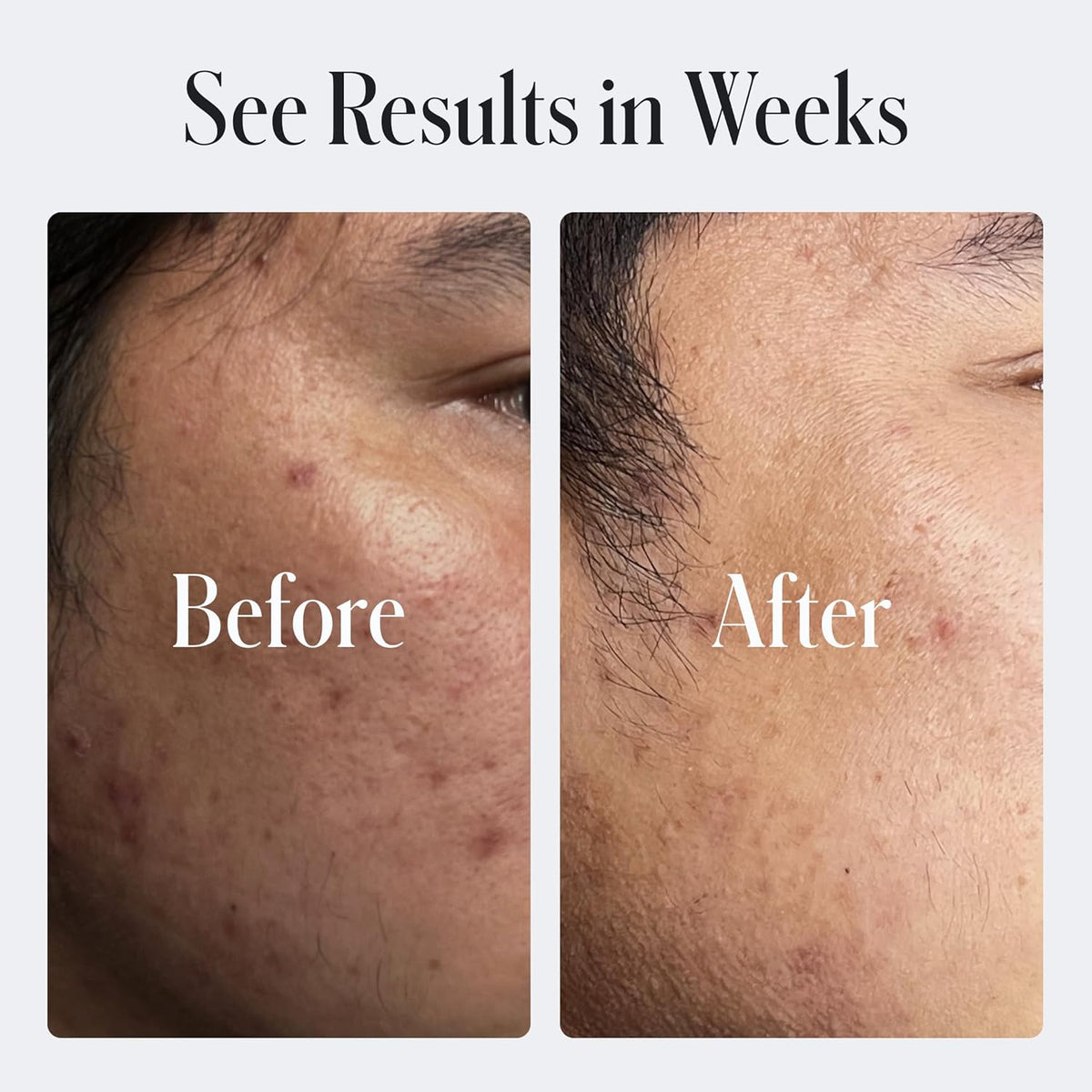 Geologie Skin Repair Moisturizer Face Cream | Clear System Retinol Resurfacing Formula | For