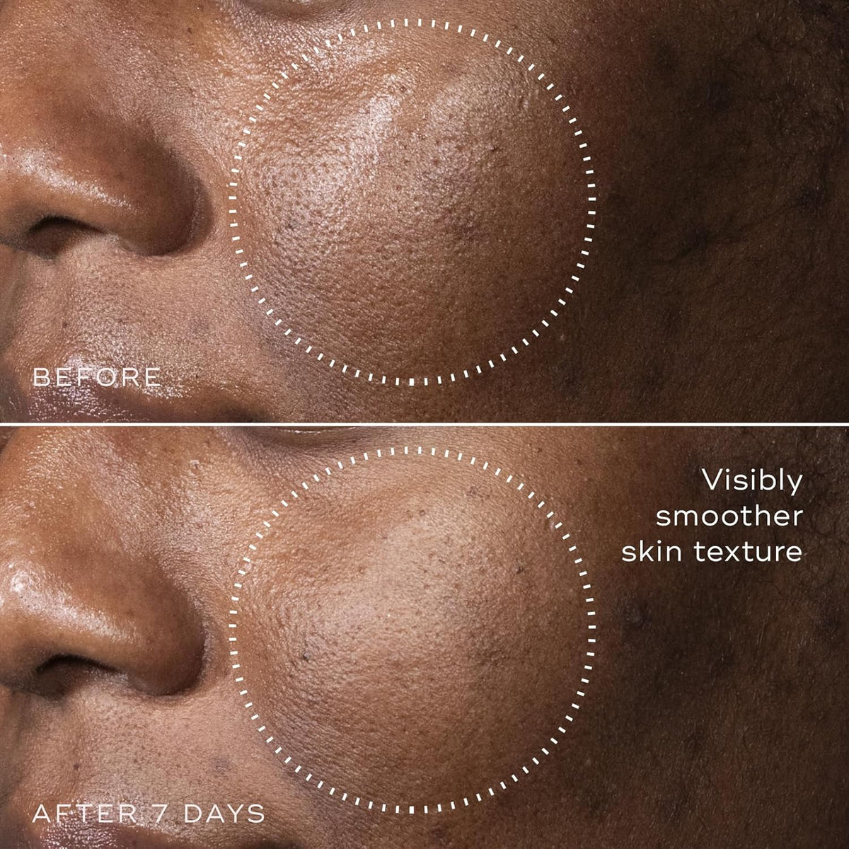 Medik8 C-Tetra Advanced - Balancing, Plumping, Hydrating Daily Vitamin C Serum with Hyaluronic