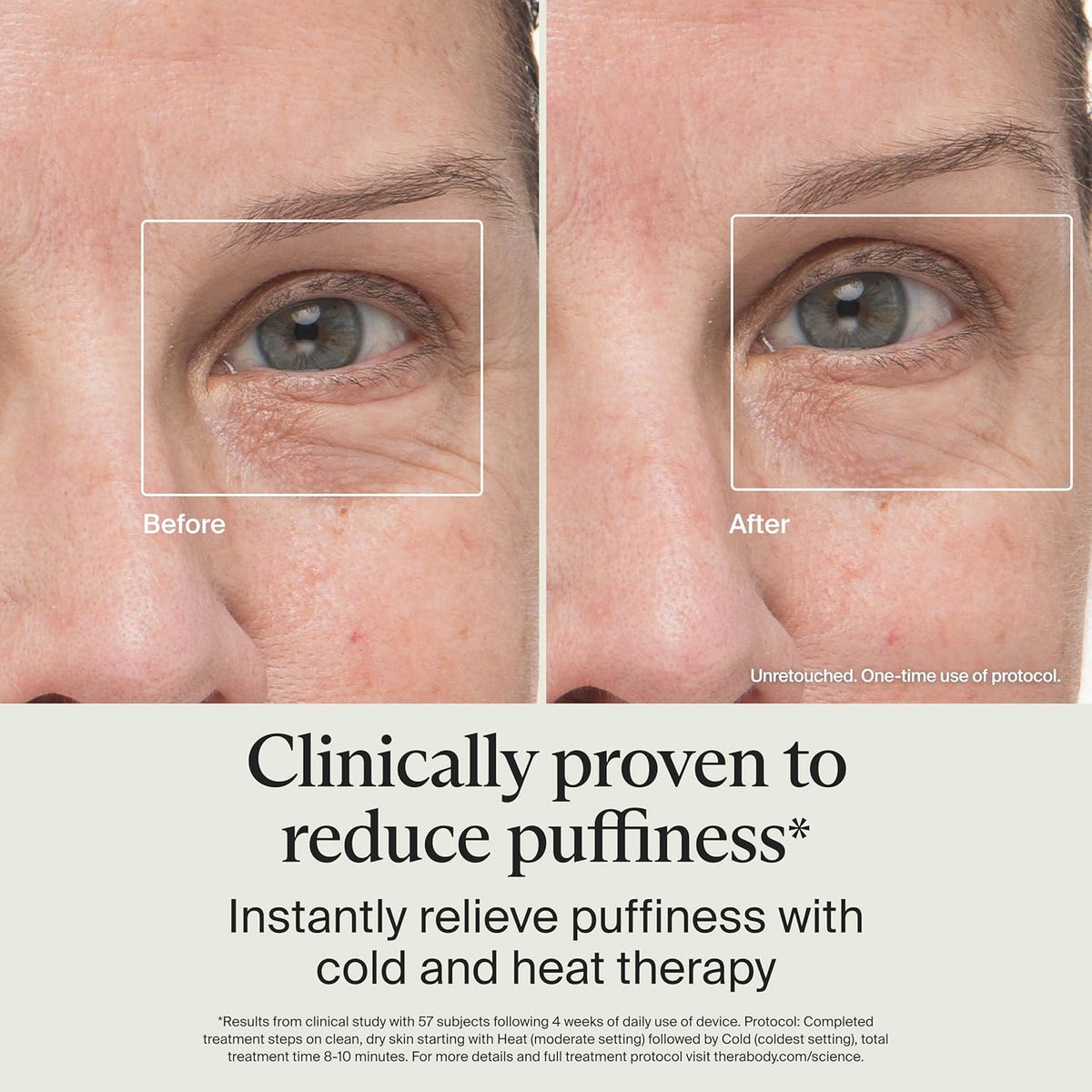 Therabody TheraFace Depuffing Wand – Cold and Heat Skincare Treatment to Depuff and Glow; Beauty