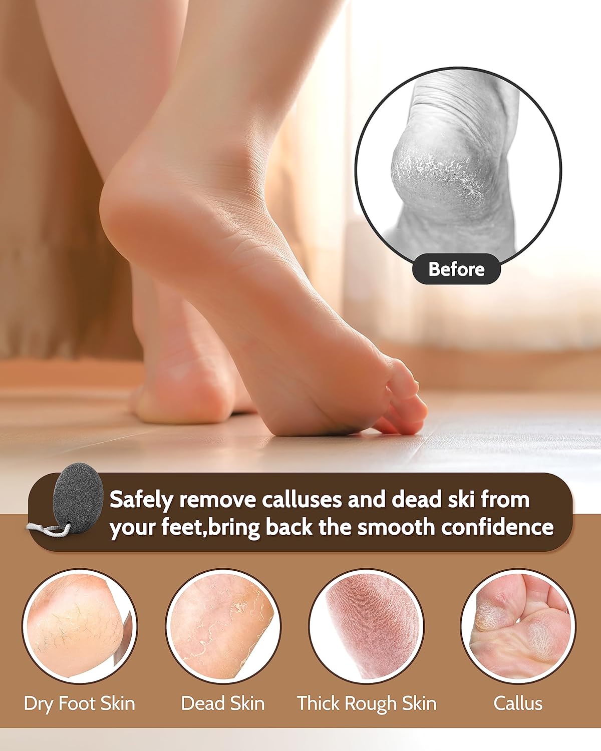 Pumice Stone Foot File, 4pcs Set Callus Remover for Feet with Wooden Handle, Pedicure Foot Scrubber