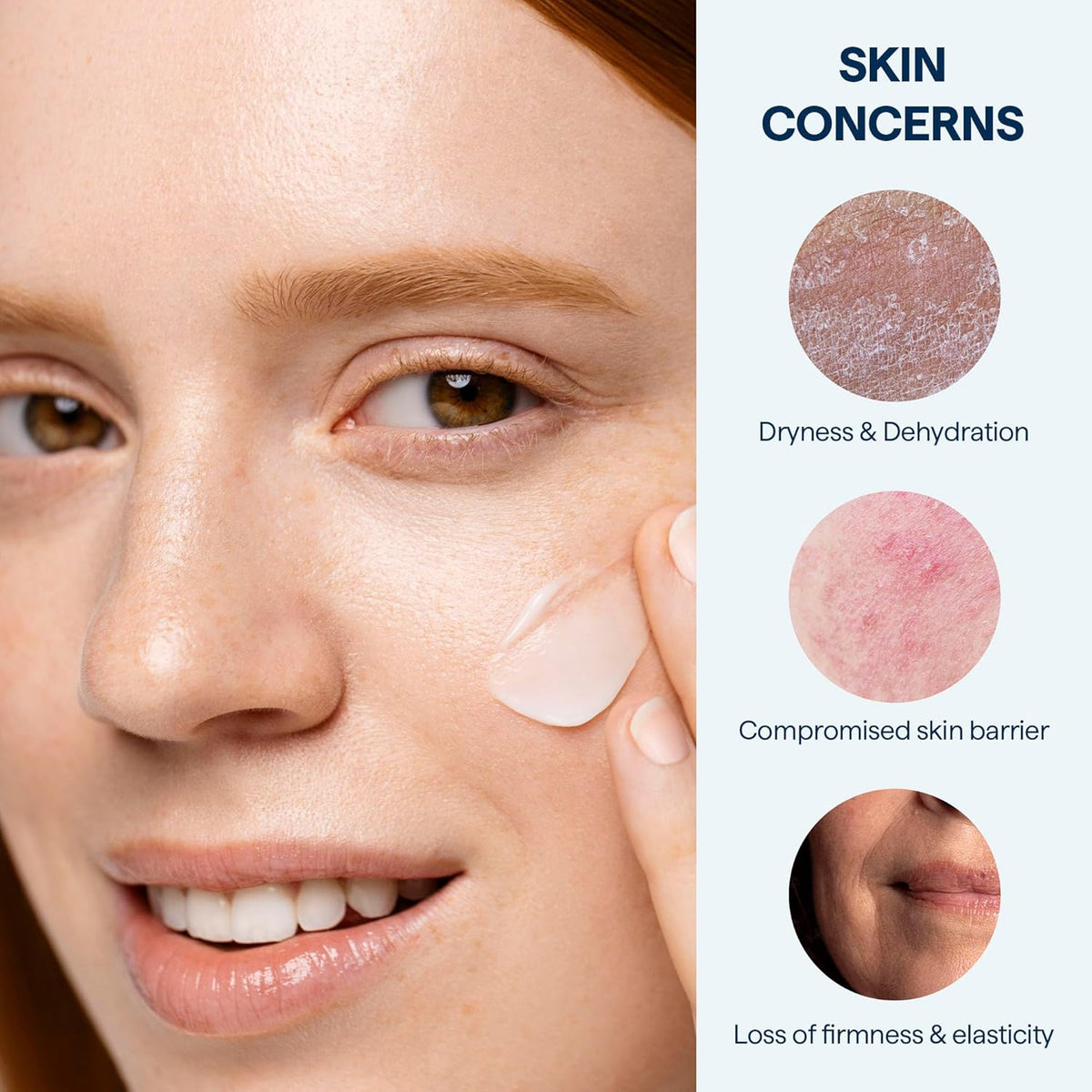 Remedy for Rich Moisture - Barrier Repairing Rich Cream Moisturizer for Normal to Dry Skin