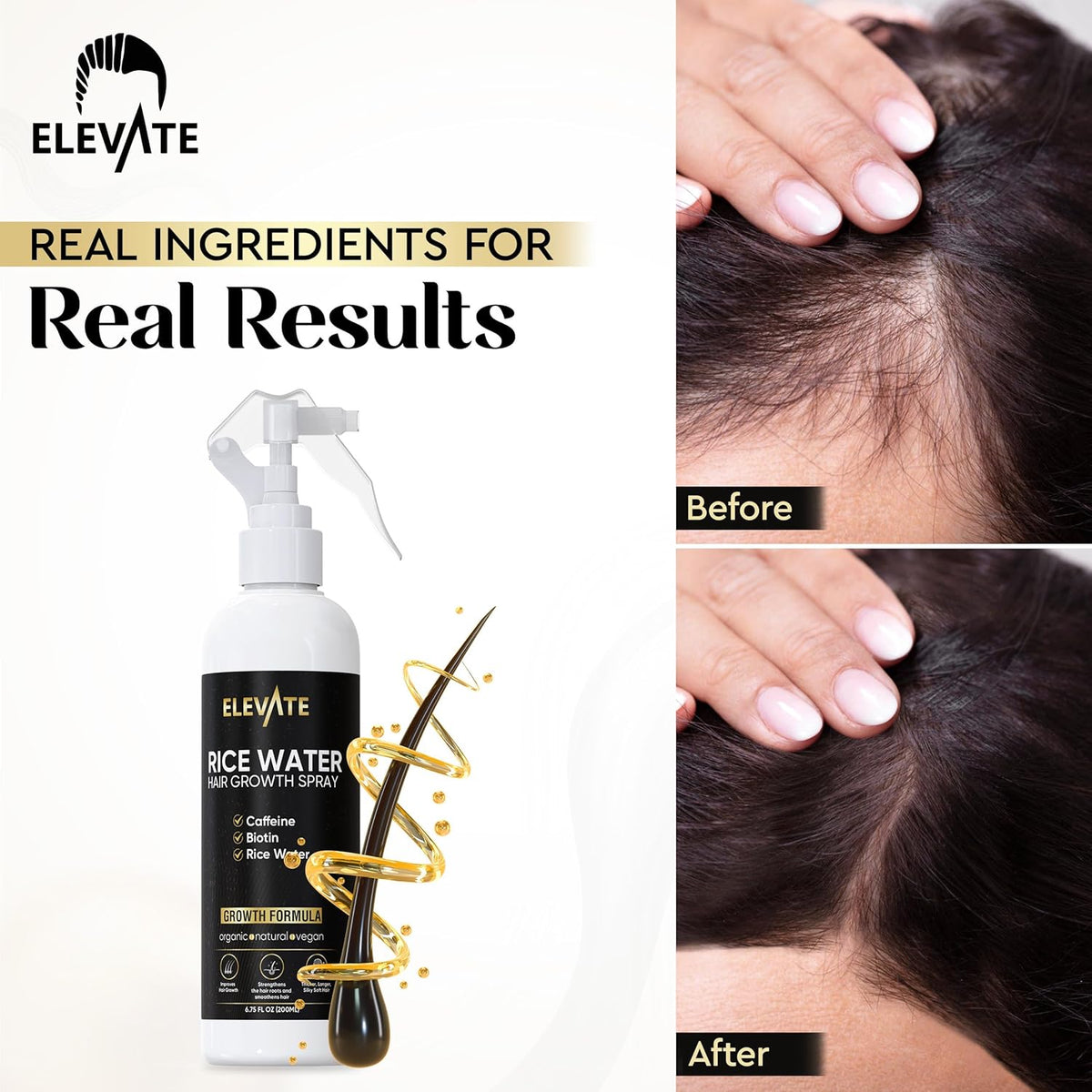 Elevate Rice Water Hair Growth Spray - Infused with Biotin, Caffeine & Aloe Vera for Thicker