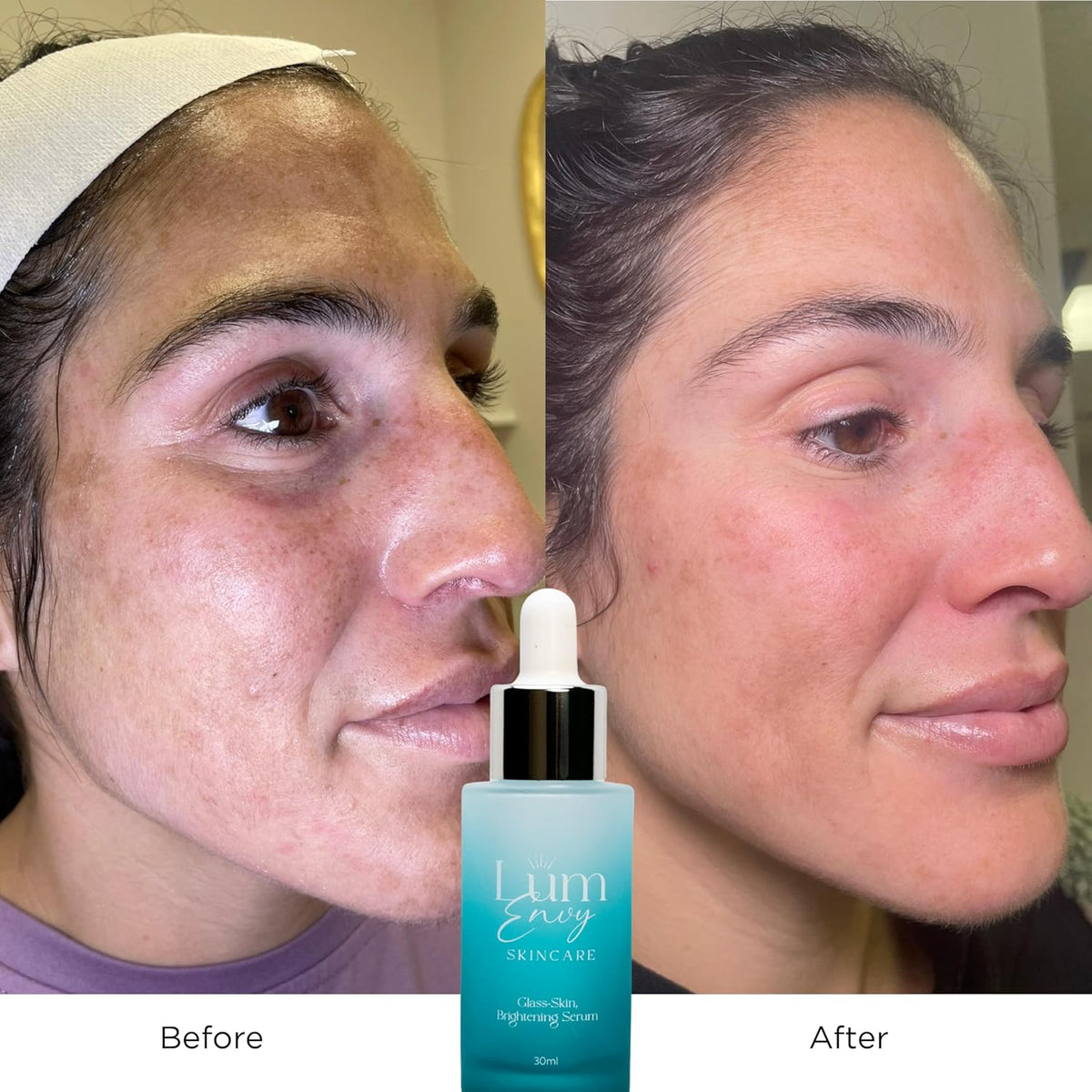 Salmon DNA Glass Skin Serum - Hydrating Korean Skincare Face Serum with PDRN, Niacinamide &