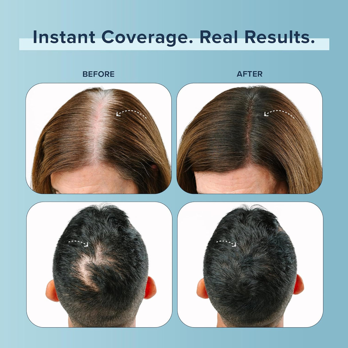 TRUHAIR Color Fibers Root Coverage & Density Booster | Quick-Apply Root Touch Up Hair Color |
