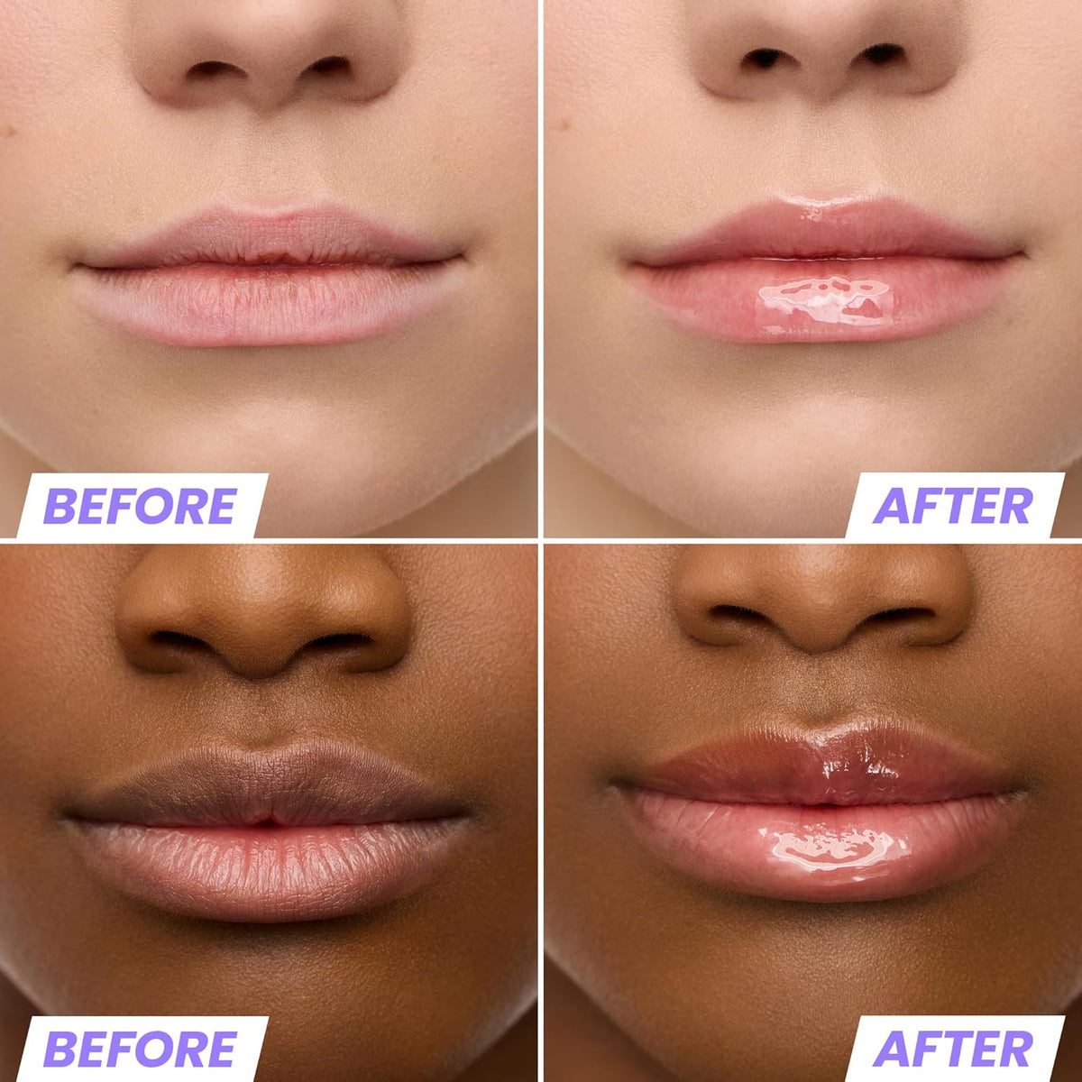 Wonderskin Lip Oil Rehab Serum - Tinted Lip Oil, Hydrating, Moisturizing, and Non-Sticky Coral Pink