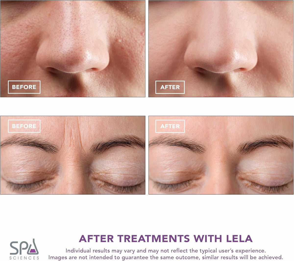 Spa Sciences - LELA - 4-in-1 Facial Spatula for Deep Cleansing, Pore Extraction, Serum Infusion