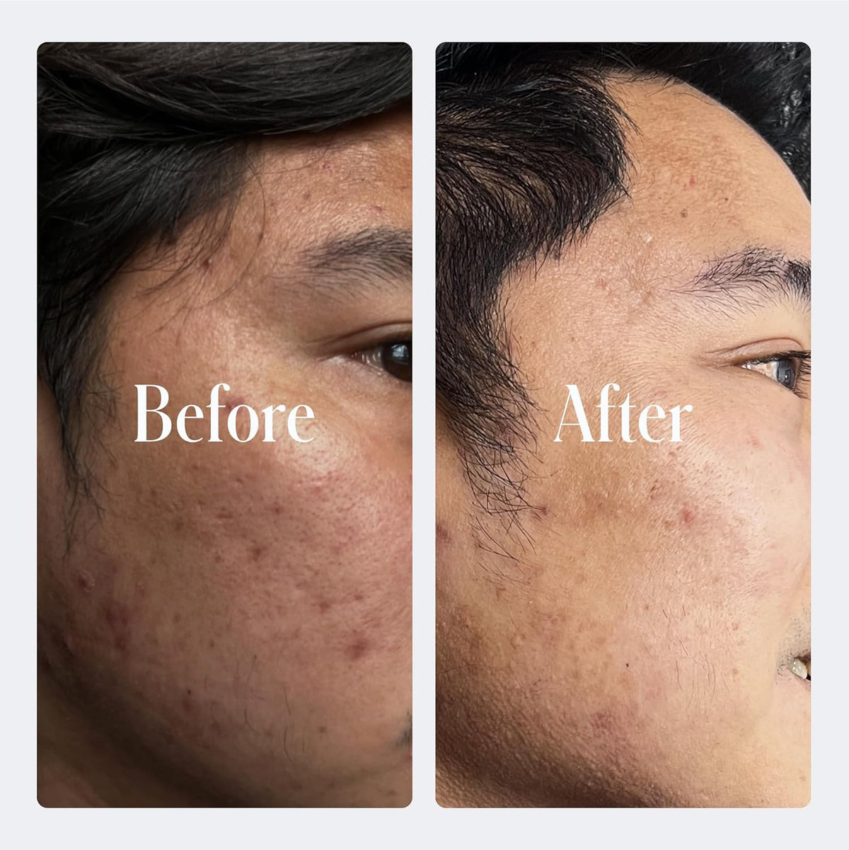 Geologie Retinol Anti-Aging Face Cream | Advanced .3% Retinol Formula for Effective Results |
