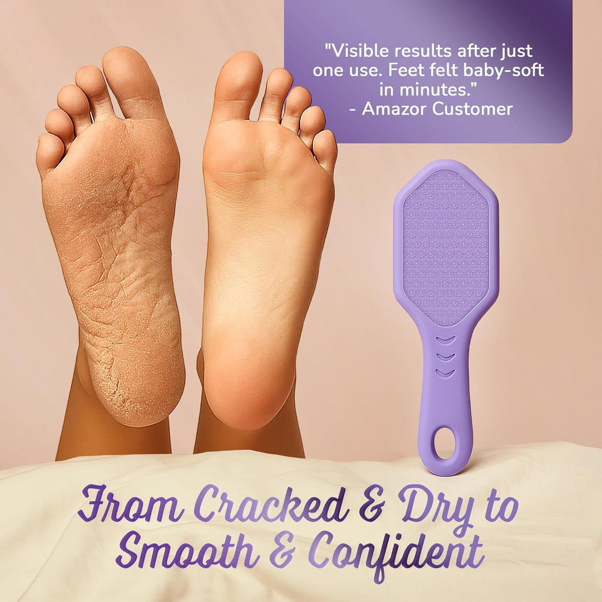 Silicone Foot Callus Remover - Nano Glass Foot File for Dead Skin and Cracked Heels - Callus