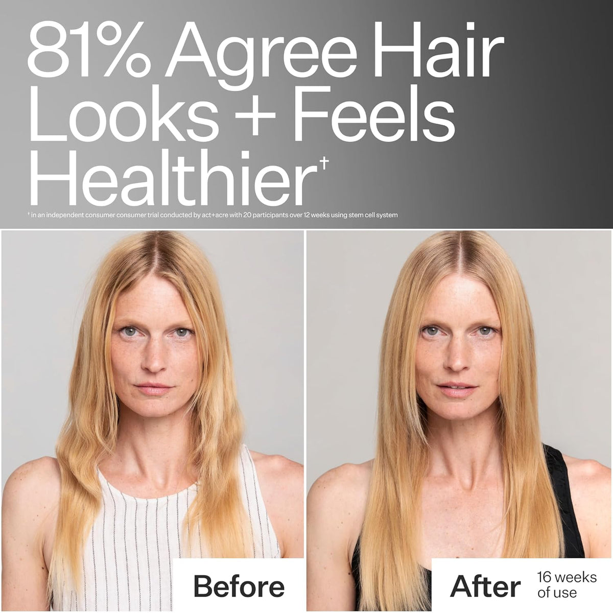ACT+ ACRE Stem Cell Shampoo | Boosts Density, Hydrates Scalp, Removes Build-Up | Thicker, Fuller