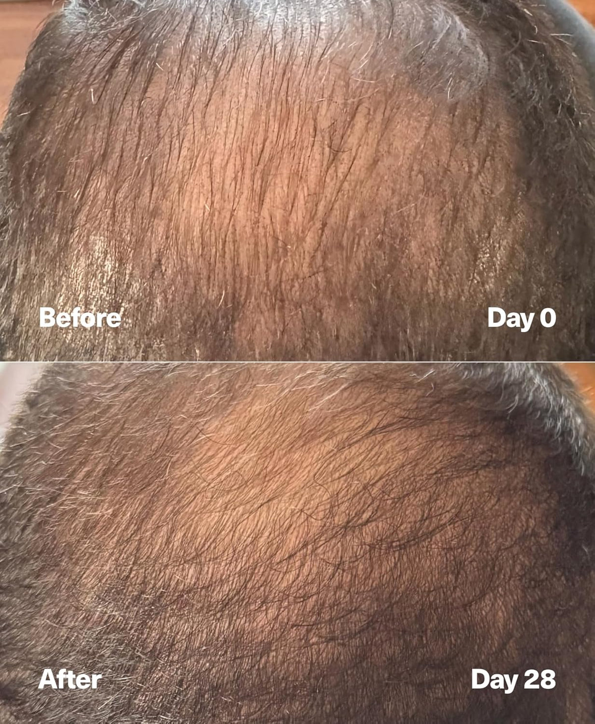 PowerCycle Exosome Hair Growth Serum - Clinically Advanced Scalp Treatment for Thinning Hair, Hair