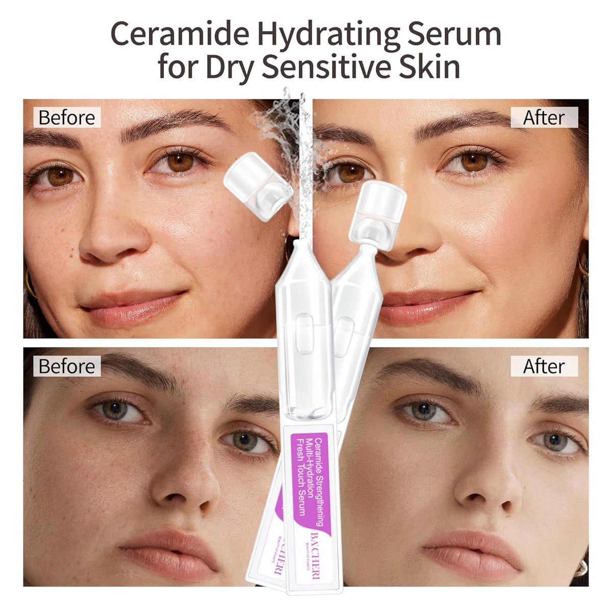 Ceramide Serum for Dry Sensitive Skin - Triple Ceramide Complex with Hyaluronic Acid, Strengthening
