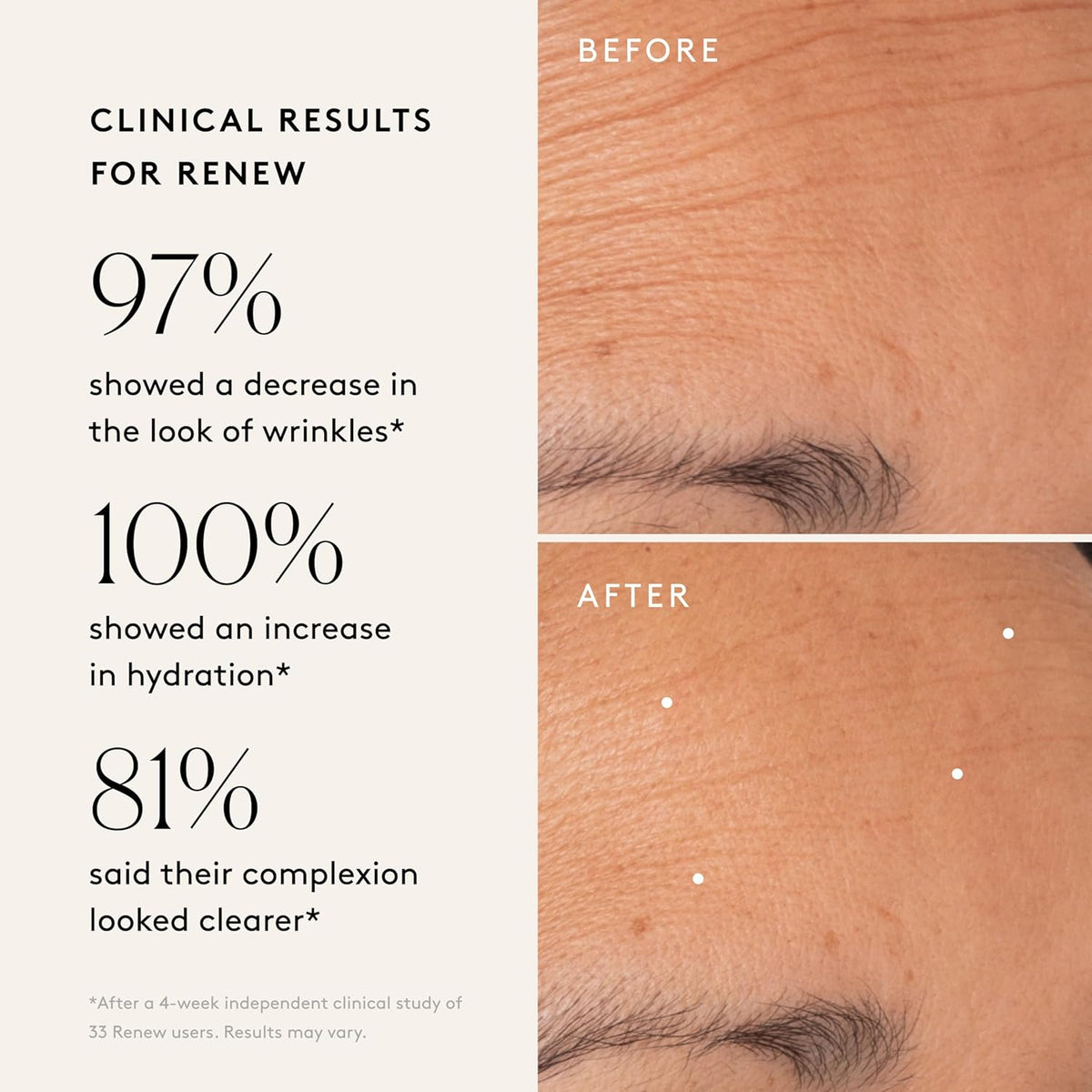 Naked & Thriving The Night Set | Renew Resurfacing Night Serum (30 mL) + Rejuvenate Restorative
