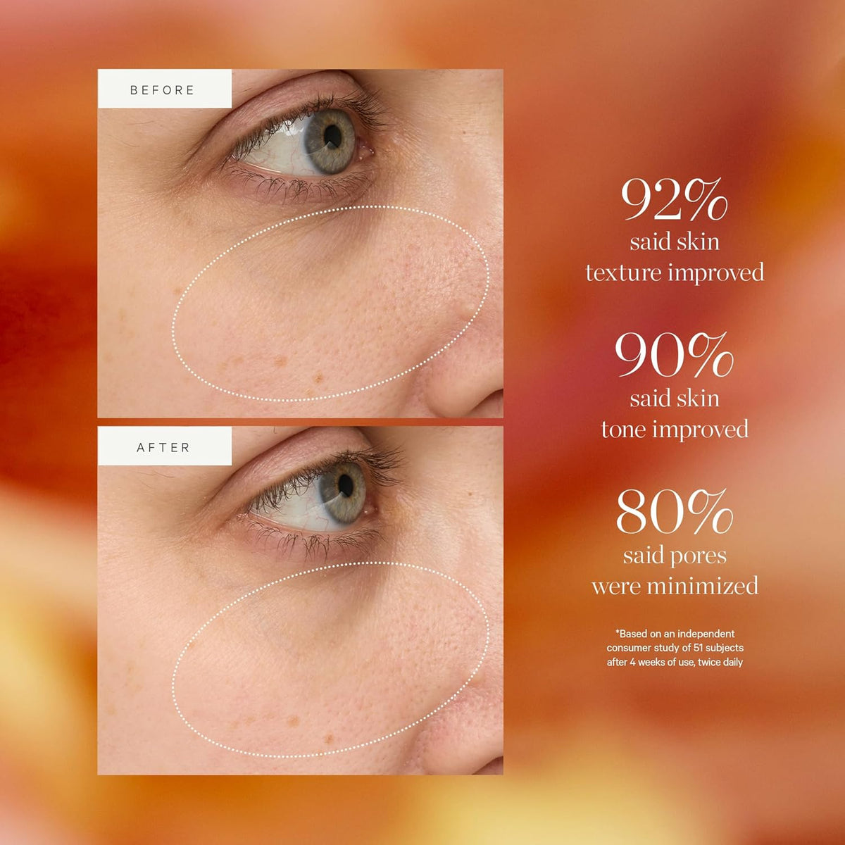 KORA Organics Turmeric Glow Drops, Niacinamide Alternative Face Serum for Radiance, Texture and