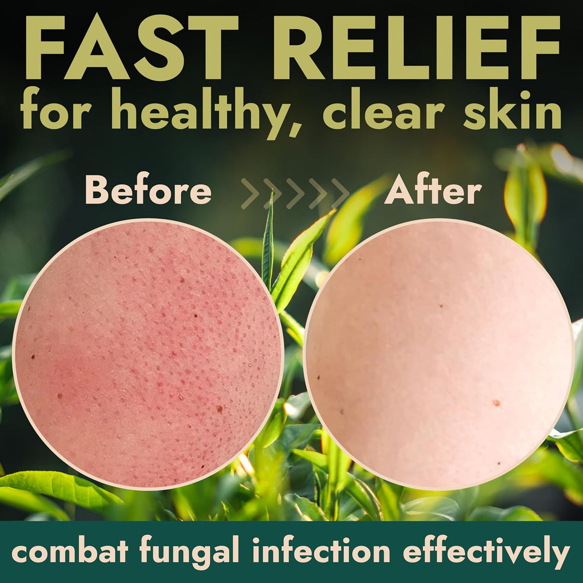 Terramed Just Think Comfort Antifungal Body Scrub with Tea Tree Oil – Exfoliating Body Wash for