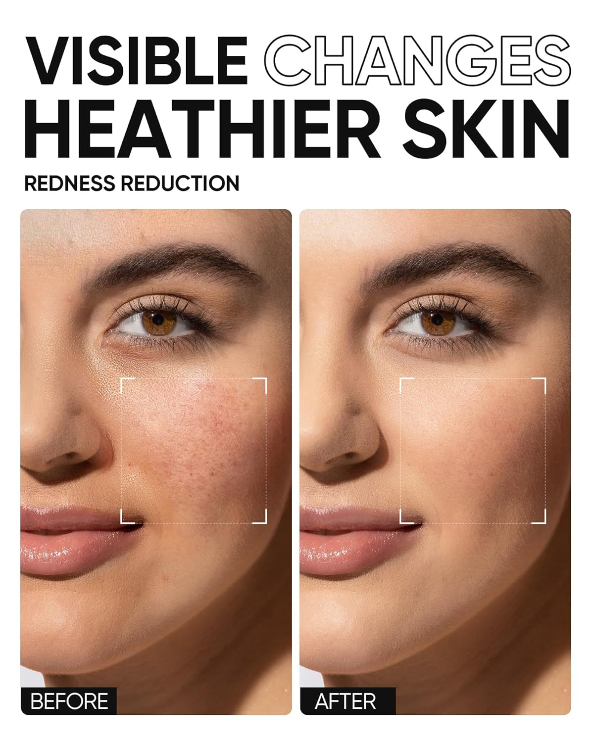 5X Ceramides Moisture Barrier Cream, Hydrating Skin Barrier Repair Face Moisturizer for All Skin