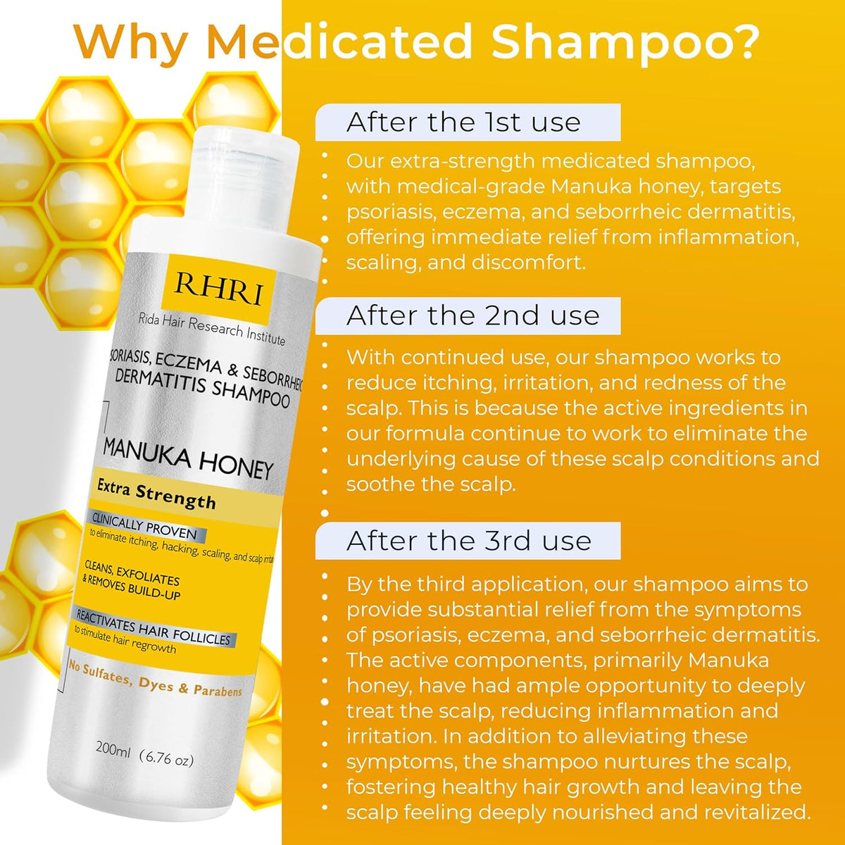 Psoriasis Shampoo for Men & Women | Itchy Scalp Treatment with Manuka Honey | Best for Eczema