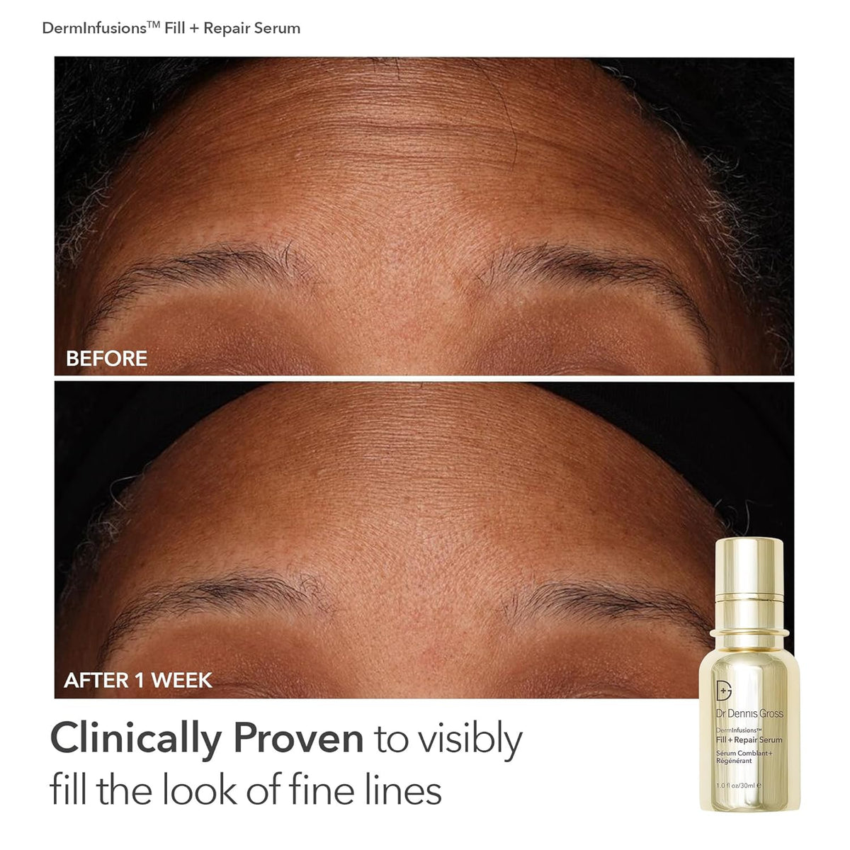 Dr. Dennis Gross Fill, Plump & Firm Kit – DermInfusions™ Hyaluronic Acid Serum, Eye Cream & Lip