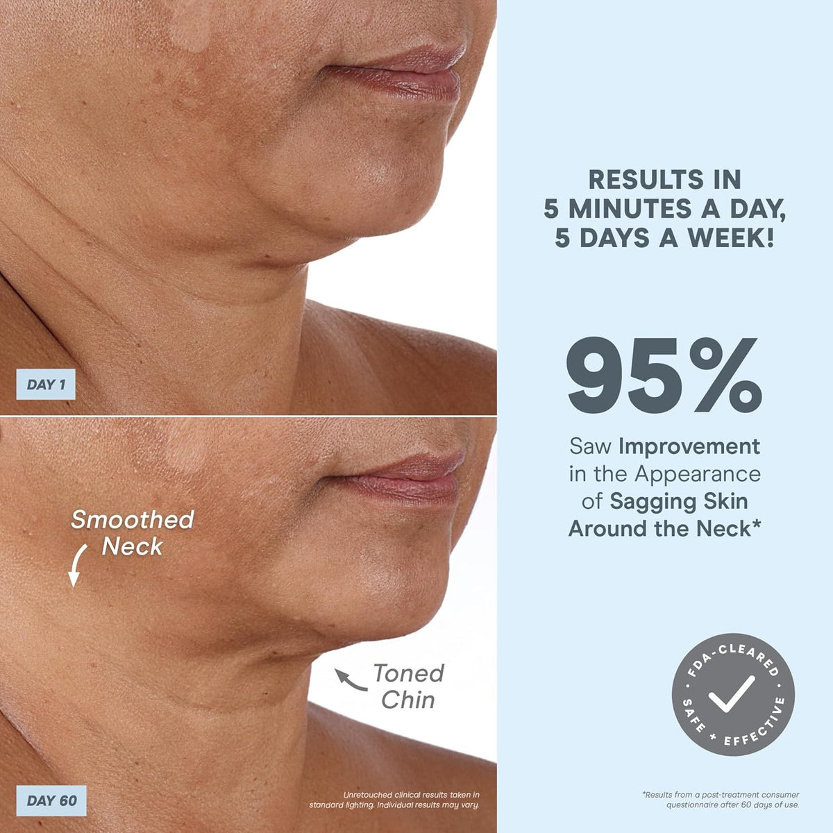 NuFACE MINI+ Microcurrent Facial Device Kit - FDA Cleared Face Sculpting & Skin Tightening Device