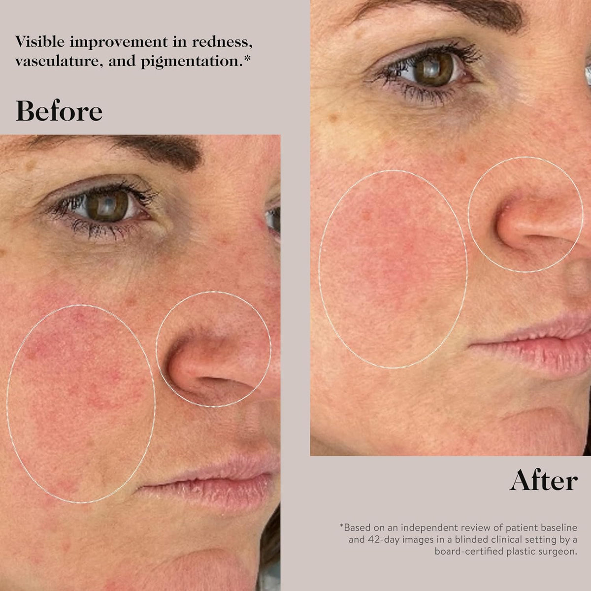 goop Beauty Peptide Serum |Reduces Fine Lines, Wrinkles, & Dark Spots | Peptides, Ceramides, &
