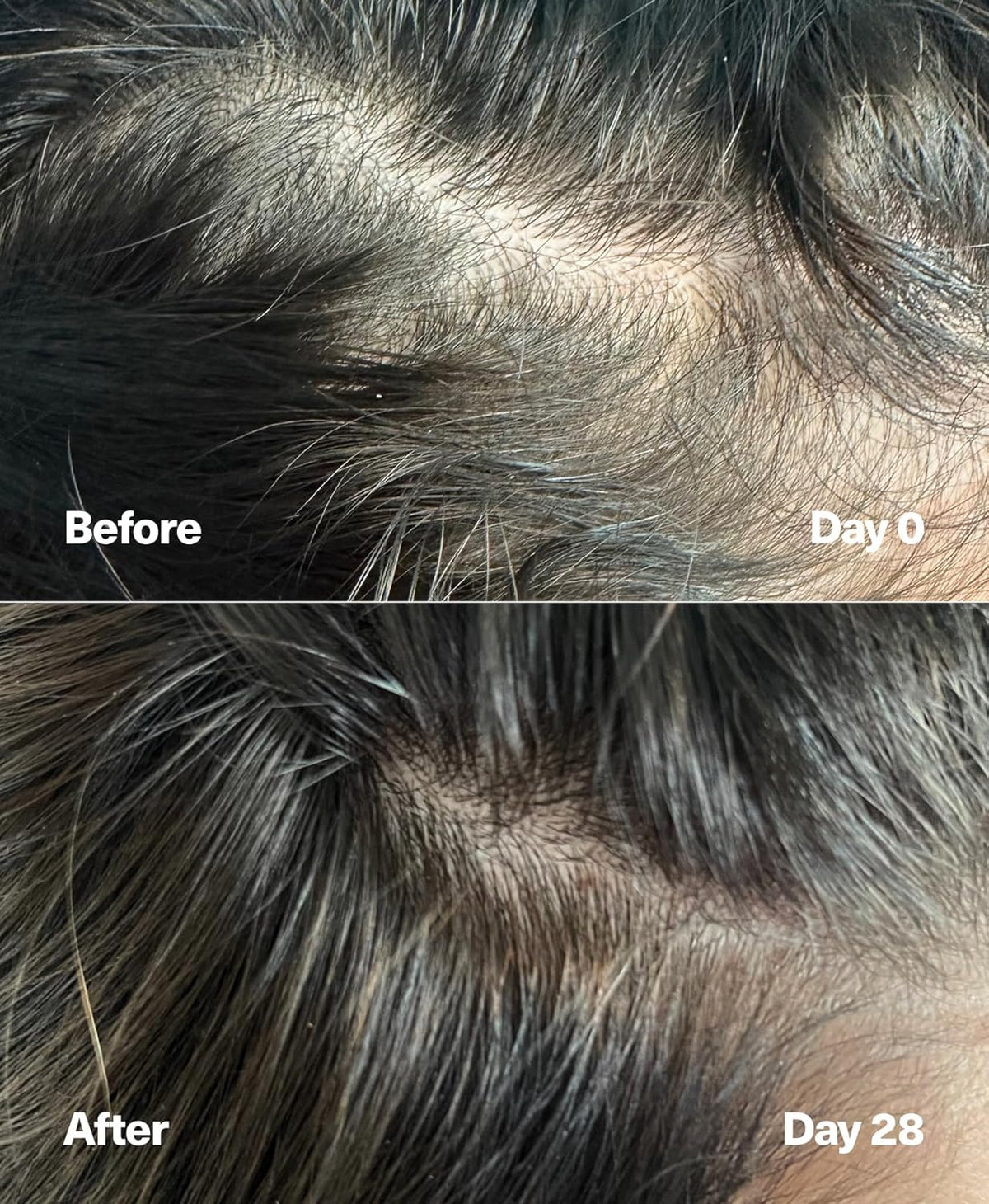 PowerCycle Exosome Hair Growth Serum - Clinically Advanced Scalp Treatment for Thinning Hair, Hair