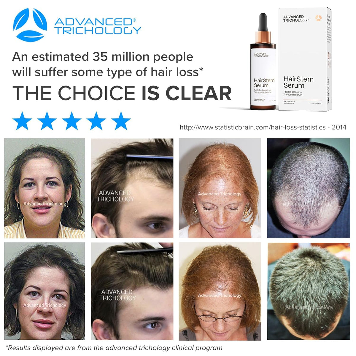 HairStem Follicle-boosting Triceutical Serum for Thicker Fuller Hair | Triple-Action, Multi-Zonal