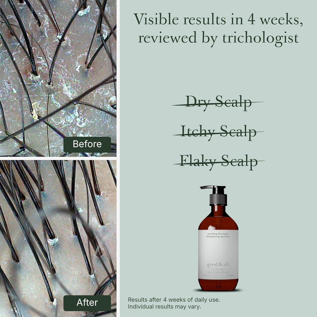 GOOD&ALL Tea Tree Shampoo for Dry Itchy Scalp with Peppermint - Sodium Lauryl Sulfate/Sulphate