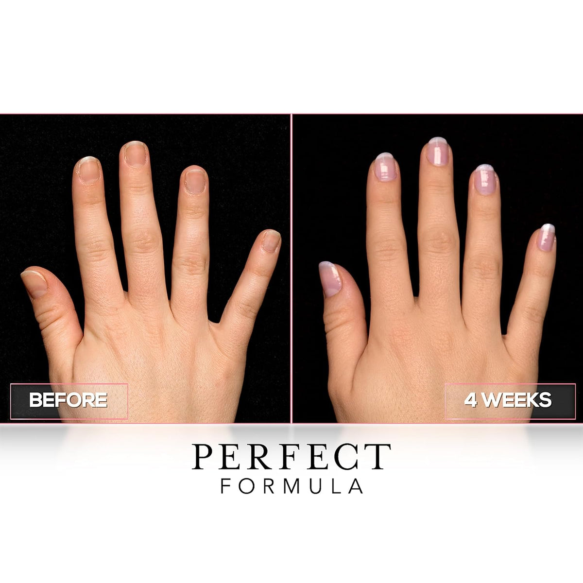 Perfect Formula Clear Gel Coat - Nail Strengthener, Keratin Treatment, Clear Nail Polish